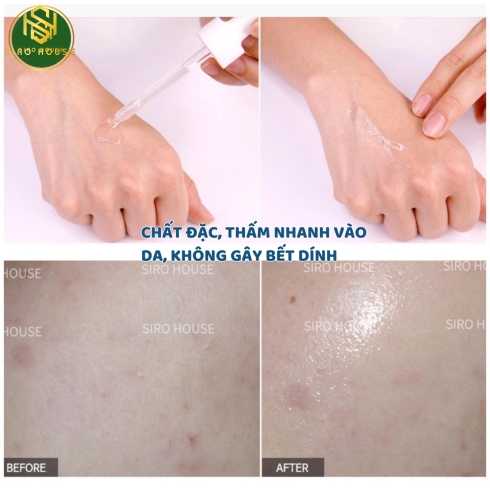 Tinh chất cấp nước TIA