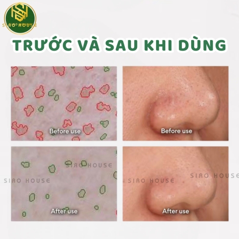 Mặt nạ đất sét tro núi lửa INNISFREE Super Volcanic Pore Clay Mask 100mL