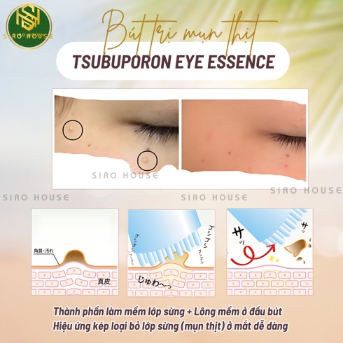 Bút trị mụn thịt TSUBUPORON Eye Essence 1.8mL