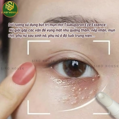 Bút trị mụn thịt TSUBUPORON Eye Essence 1.8mL