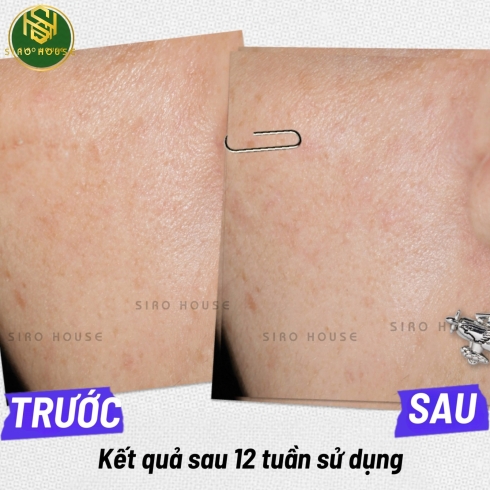 Tinh chất dưỡng trắng, trị thâm KIEHL