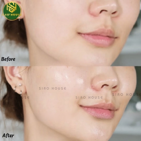 Tinh chất cấp ẩm, phục hồi da TORRIDEN Balanceful Serum 50mL