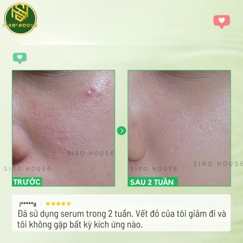 Tinh chất cấp ẩm, phục hồi da TORRIDEN Balanceful Serum 50mL