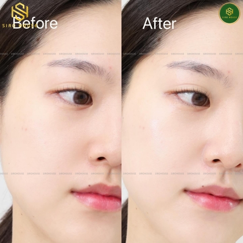 Mặt nạ dẻo TORRIDEN Balanceful Modeling Pack 