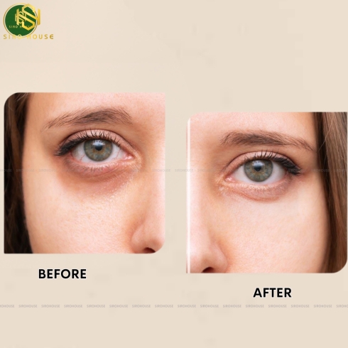  Kem dưỡng mắt AHC Premier Ampoule In Eye Cream Collagen T4 40mL 