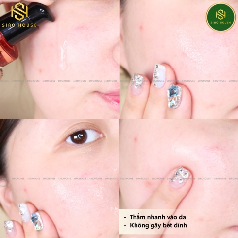 Serum ốc sên SOME BY MI Snail Truecica Miracle Repair Serum 50mL