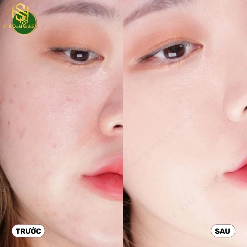  Set phấn nước APRIL SKIN HERO Cushion Blossom Edition + tặng kèm lõi