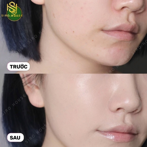  Set phấn nước APRIL SKIN HERO Cushion Blossom Edition + tặng kèm lõi
