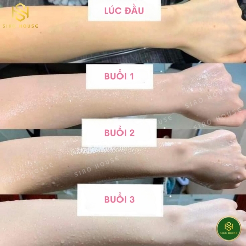 Dưỡng thể kích trắng da PERFECT SKIN LADY Alpha Arbutin 3 Plus+ Collagen Lotion 500mL