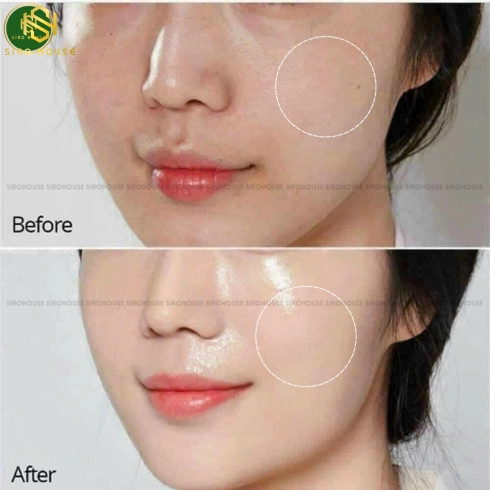 Kem dưỡng K LADY CARE Intensive Anti-Aging 80mL 