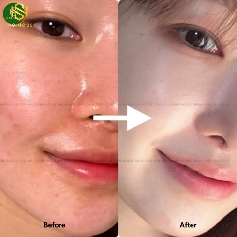 Kem dưỡng K LADY CARE Intensive Anti-Aging 80mL 