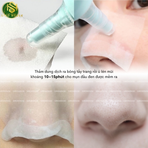 Tinh chất ủ mụn đầu đen ILSO Sebum Super Melting Serum Softener 150mL