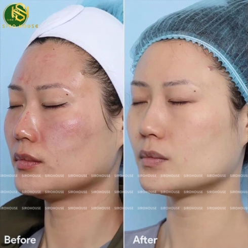 Mặt nạ SKIN LAB Glass Skin Aquaring Mask 30g 