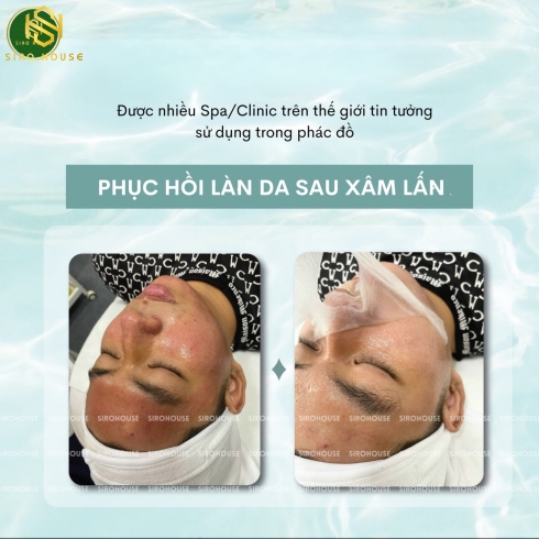 Mặt nạ SKIN LAB Glass Skin Aquaring Mask 30g 