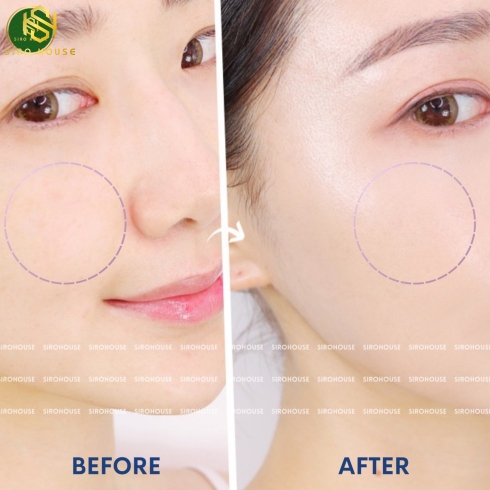 Tẩy Tế Bào Chết HATOMUGI Peeling & Facial Cleansing Gel 120g