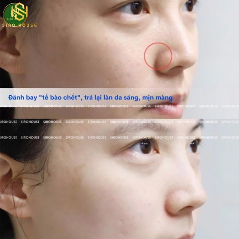 Tẩy Tế Bào Chết HATOMUGI Peeling & Facial Cleansing Gel 120g