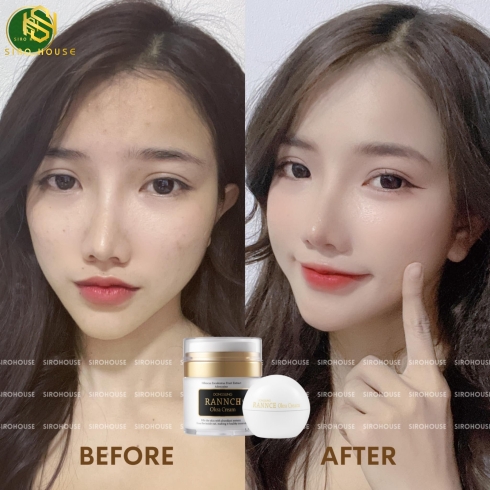 Kem dưỡng DONGSUNG Rannce Okra Cream 50g