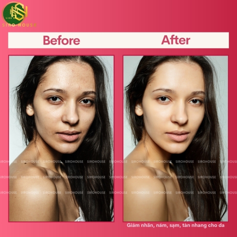 Collagen nước NATURE