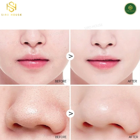 Sữa rửa mặt tẩy tế bào chết ST.IVES 170g