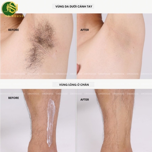 Kem tẩy lông FREEMO FACTORY Body Hair Remover 80g