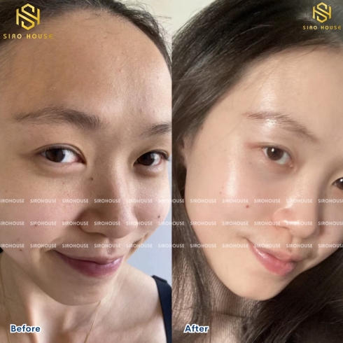 Mặt nạ cấp ẩm, dưỡng trắng, phục hồi da Sena Demar Sodium DNA B5 mask