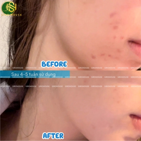 Gel Rửa Mặt La Roche-Posay 400ml