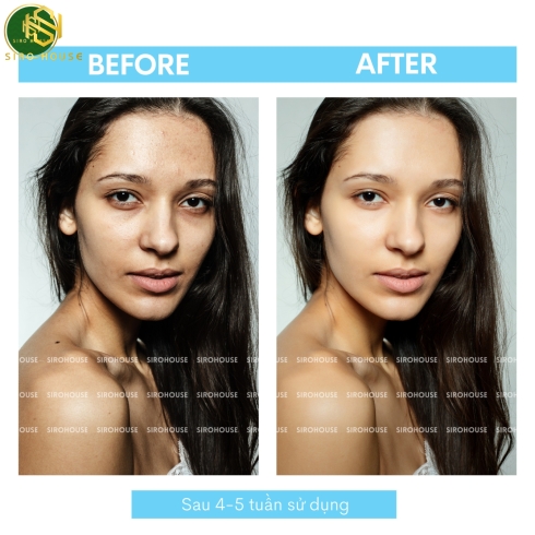 Gel rửa mặt LA ROCHE POSAY Effaclar 200mL