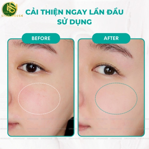 Mặt nạ đất sét APERIRE Spa Relief Be Frozen 120g 