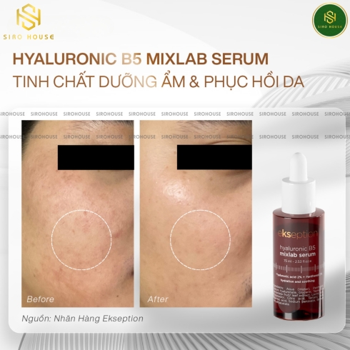 Tinh chất phục hồi và làm dịu da EKSEPTION Hyaluronic B5 Mixlab Serum 75mL