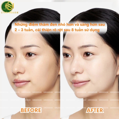Kem dưỡng Dr.Jart+ V7 Toning Bright Cream dưỡng trắng 50ml & 15ml