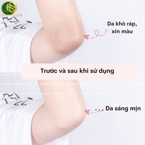 Tẩy tế bào chết toàn thân DOVE Body Scrub Sakura Fragrance 298g