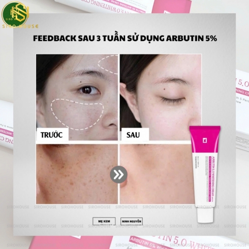 Kem dưỡng trị nám TOSOWOONG Arbutin 5.0 Whitening Cream 50mL 