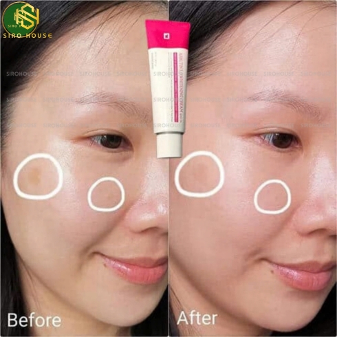 Kem dưỡng trị nám TOSOWOONG Arbutin 5.0 Whitening Cream 50mL 