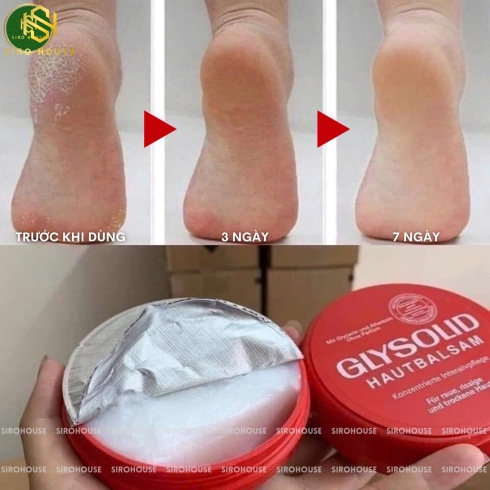 Kem nẻ GLYSOLID Hautbalsam chống da khô nứt nẻ 100mL