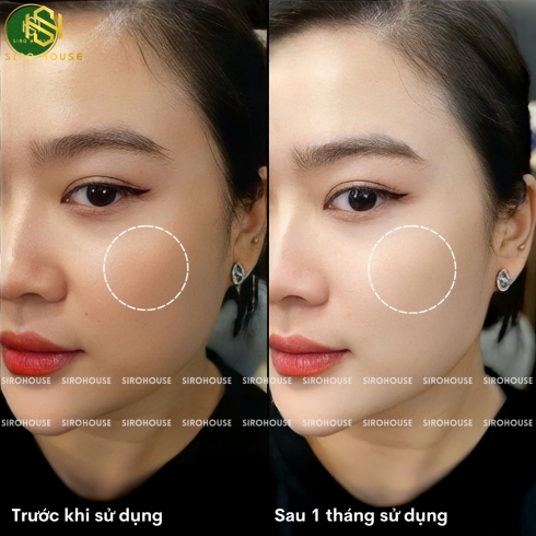 Kem ủ trắng cô gái APATHEIA Glowing Packu 500g 