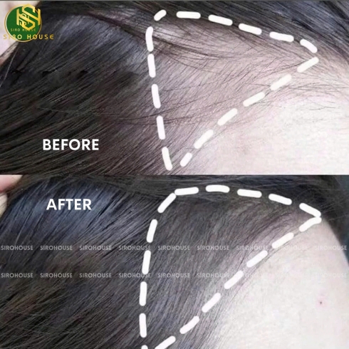 Phấn che hói THE FACE SHOP Quick Hair Puff 7g