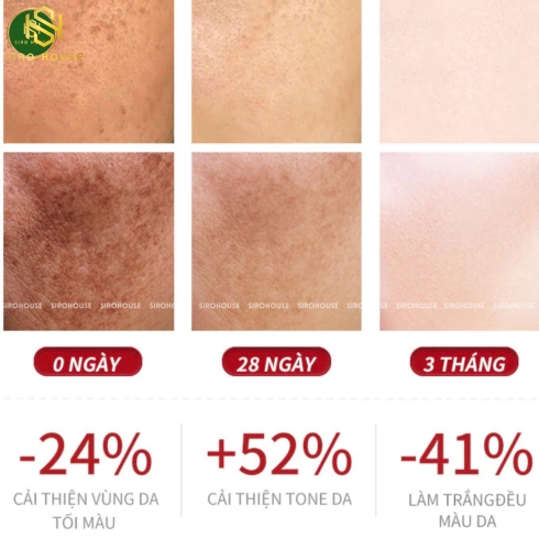 Kem dưỡng ngừa nám, tàn nhang DEMEJINE ngày-đêm 20g