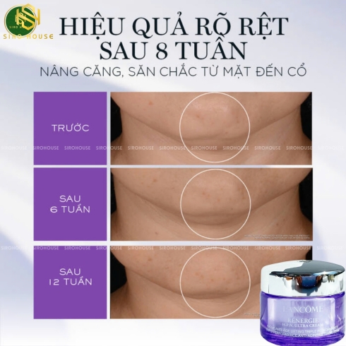 Kem dưỡng hỗ trợ nâng cơ, trẻ hoá da LANCOME Rénergie H.P.N Ultra Cream 15mL 
