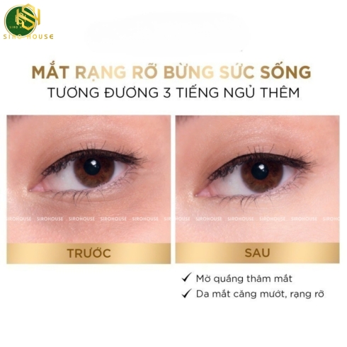 Tinh chất dưỡng mắt L