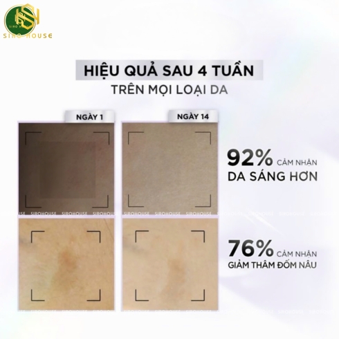 Tinh chất dưỡng mắt L