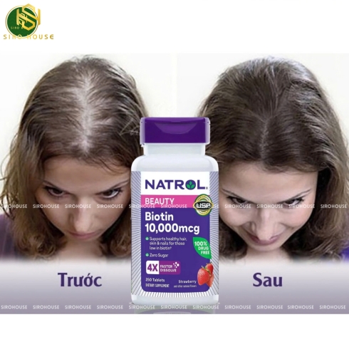 Viên ngậm mọc tóc NATROL Beauty Biotin 10,000 mcg 4X Faster Dissolve 250 viên