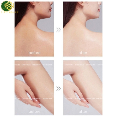Kem dưỡng ẩm REDWIN Vitamin E Cream 300g 