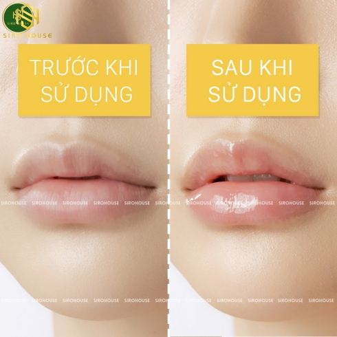 Dưỡng đa năng keo ong CNP Laboratory Propolis Multi Ampule Balm 7g