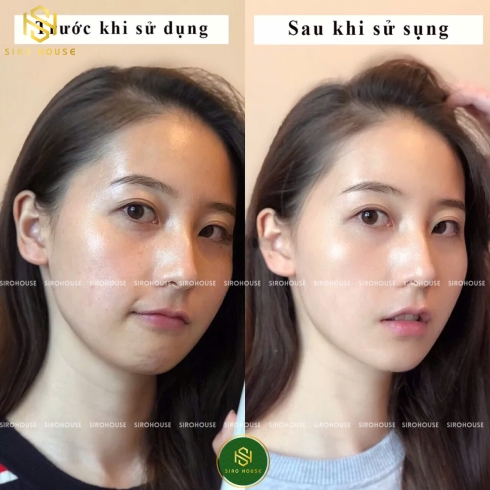 Sữa rửa mặt gạo SKINFOOD Rice Cleansing Foam 150mL