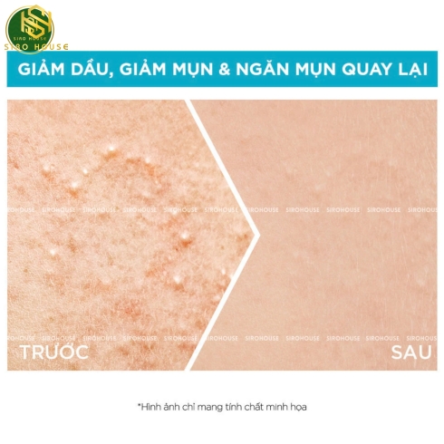 Tinh chất giảm mụn, mờ thâm GARNIER Bright Complete Anti-Acne Booster Serum 30mL