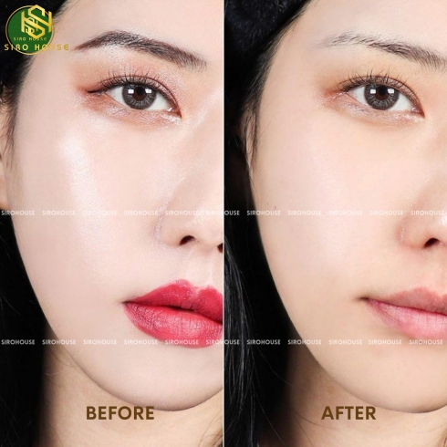 Dầu tẩy trang SKIN1004 Madagascar Centella Light Cleansing Oil 200mL