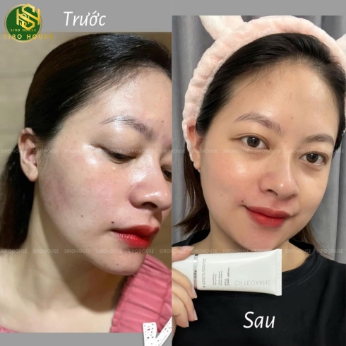 Kem dưỡng ẩm phục hồi TEOXANE Deep Repair Balm 30ml