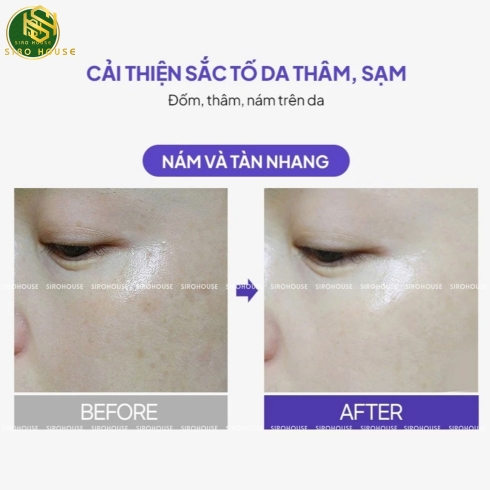 Kem dưỡng mờ nám, chống lão hóa Melatonin Liposome 5% Cream 50g