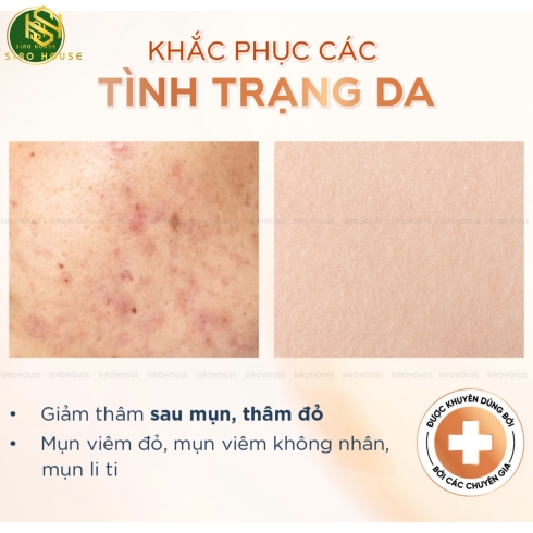 Gel giảm mụn ACTIDEM Derma Extra Gel 18g 