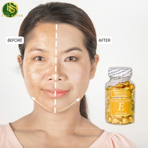 Viên nang bôi dưỡng da vitamin E sữa ong chúa HEALTH PRO Royal Jelly E 90 viên